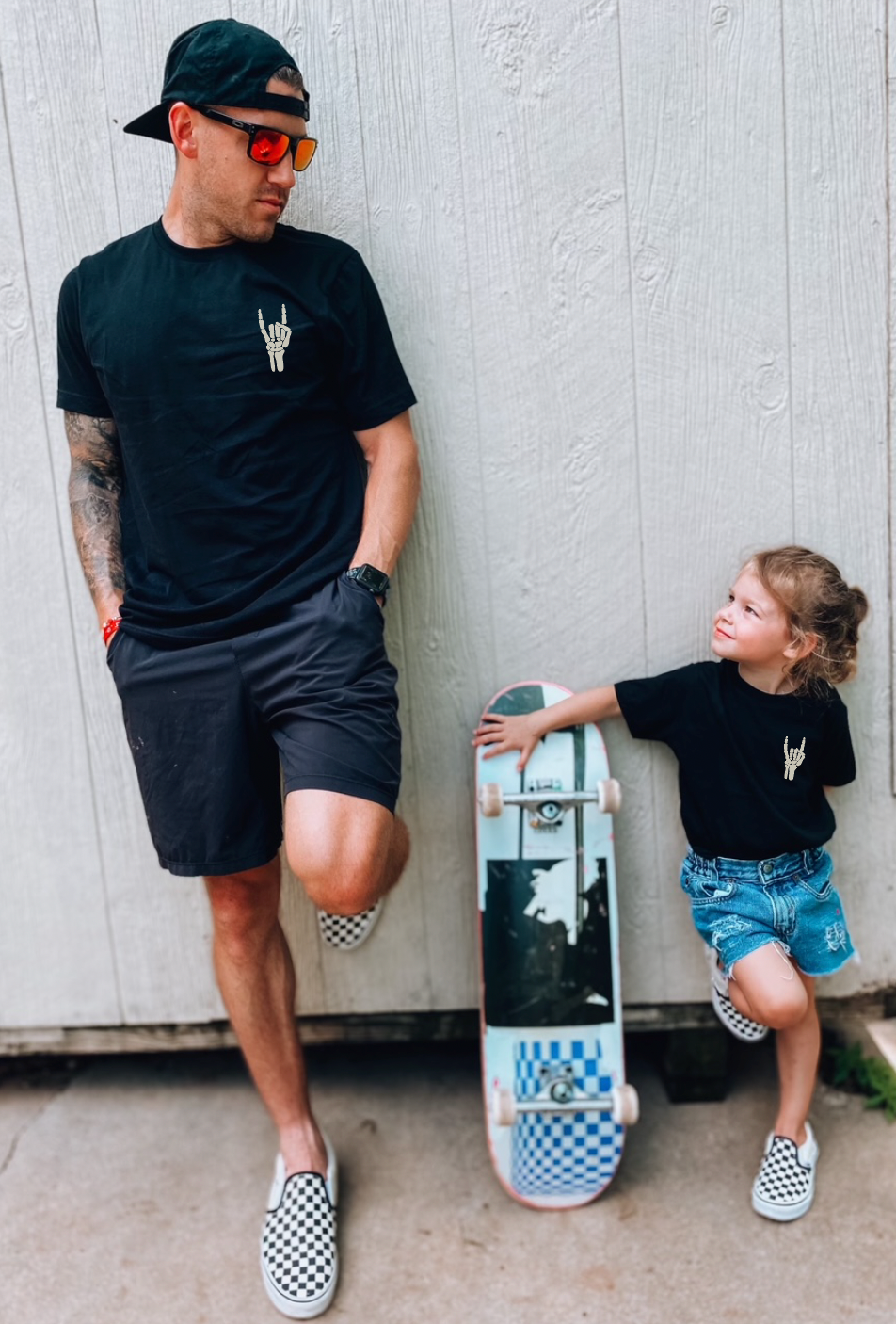 RAD to the Bone