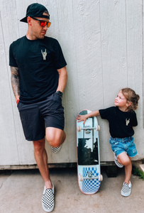 RAD to the Bone