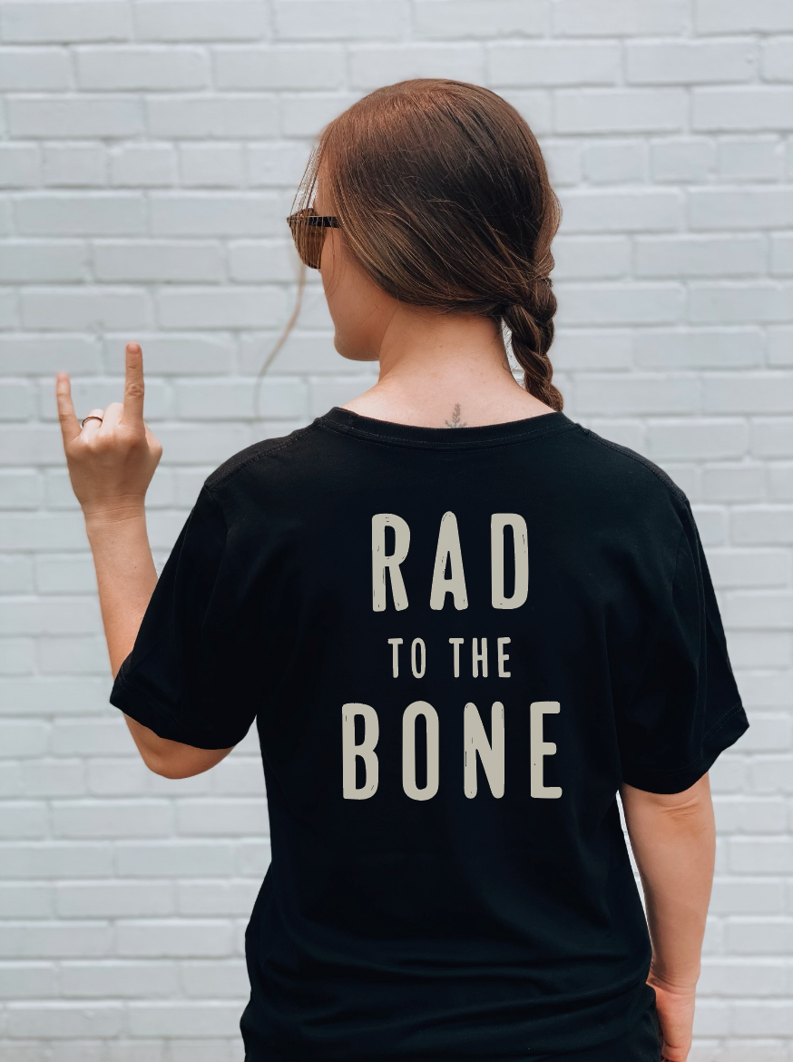 RAD to the Bone